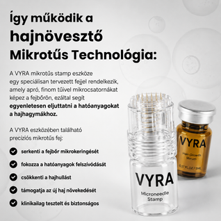 GROW Arany Mikrotűs Hajnövesztő Kezelés Férfiaknak