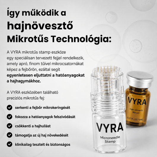 GROW Arany Mikrotűs Hajnövesztő Kezelés Férfiaknak
