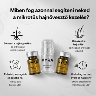 GROW Arany Mikrotűs Hajnövesztő Kezelés Férfiaknak