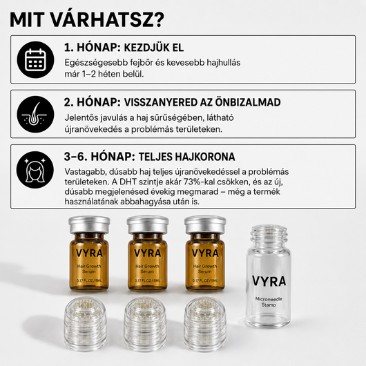 GROW Arany Mikrotűs Hajnövesztő Kezelés Férfiaknak
