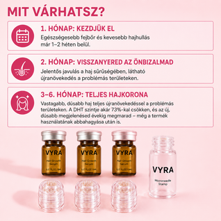 GROW Arany Mikrotűs Hajnövesztő Kezelés Nőknek