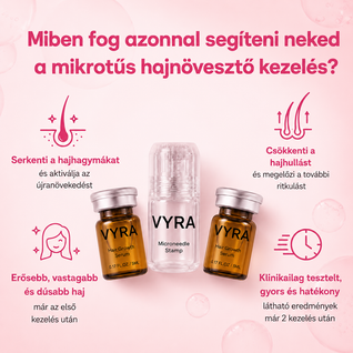 GROW Arany Mikrotűs Hajnövesztő Kezelés Nőknek