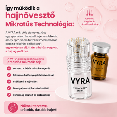 GROW Arany Mikrotűs Hajnövesztő Kezelés Nőknek