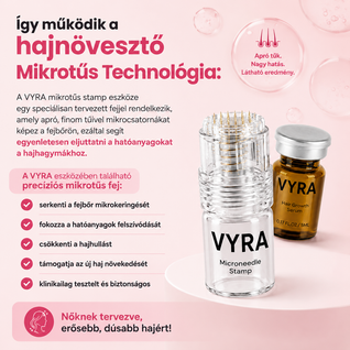 GROW Arany Mikrotűs Hajnövesztő Kezelés Nőknek